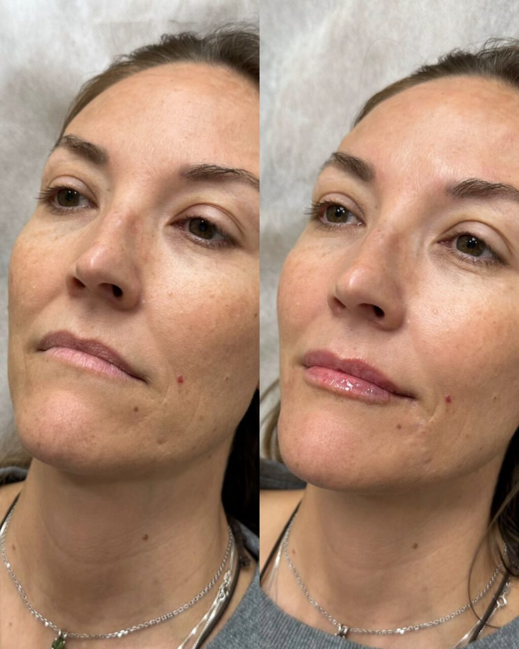 Before and after photos displaying effects of comprehensive skincare treatment on mature skin.