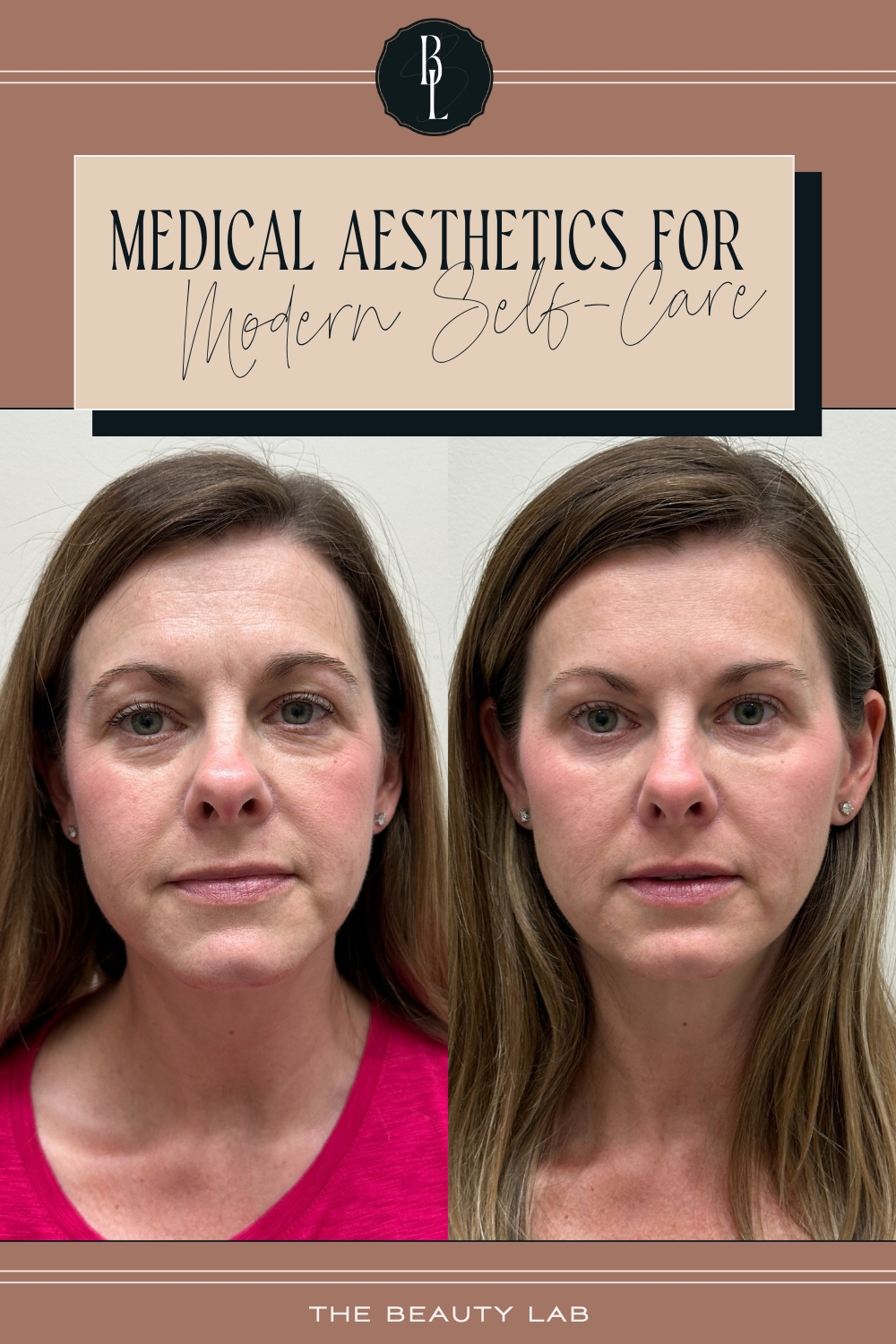 Medical aesthetics for modern self-care