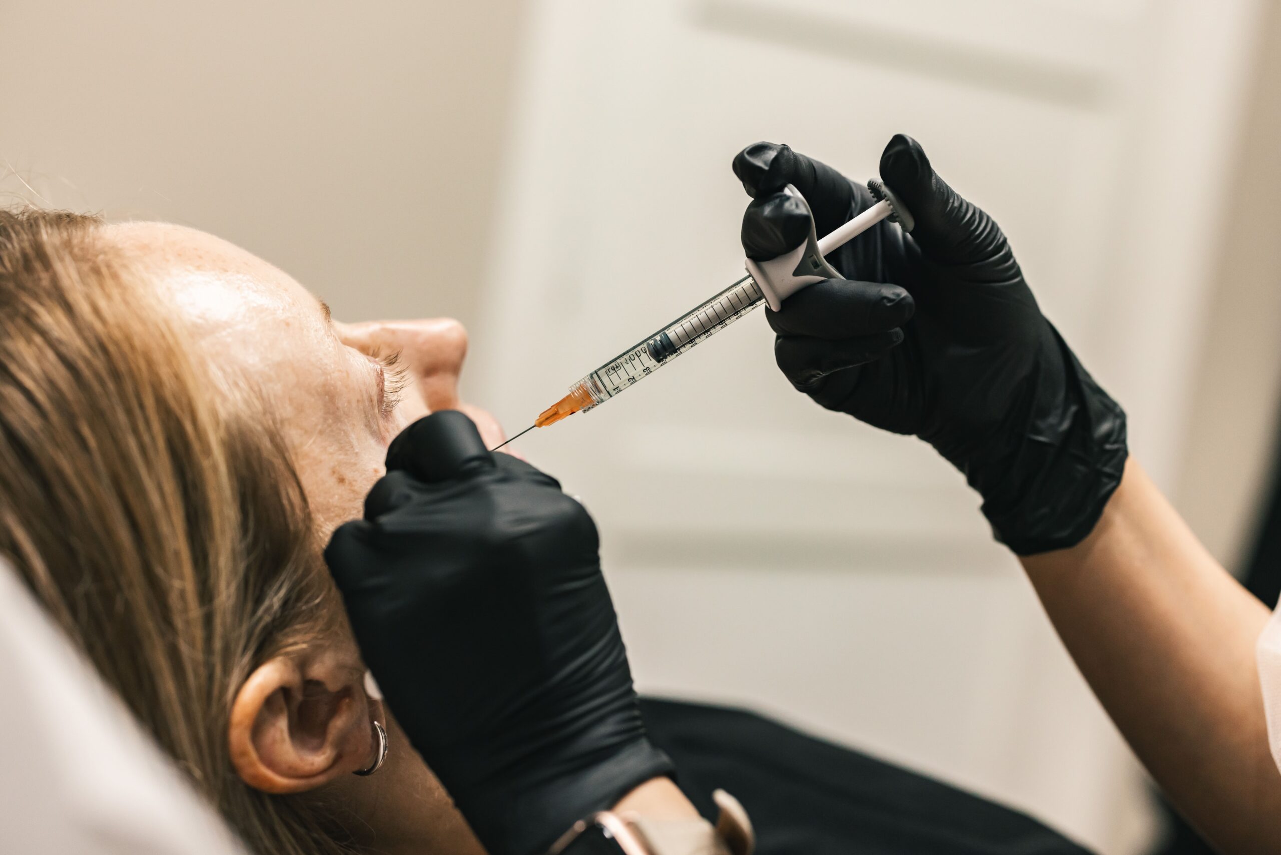 First-time dermal filler patient in Mesa, AZ receiving a safe and natural-looking wrinkle filler treatment.